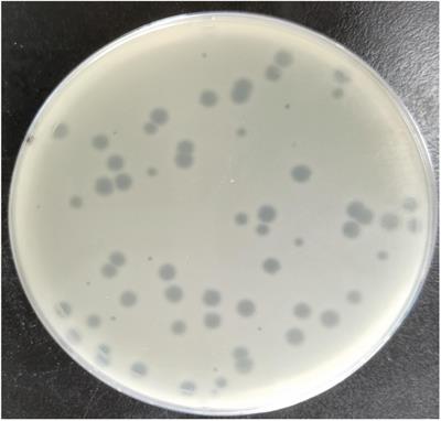 Virulent Drexlervirial Bacteriophage MSK, Morphological and Genome Resemblance With Rtp Bacteriophage Inhibits the Multidrug-Resistant Bacteria